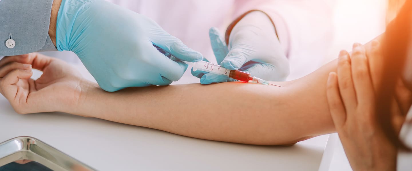 Allergy Screening Portsmouth