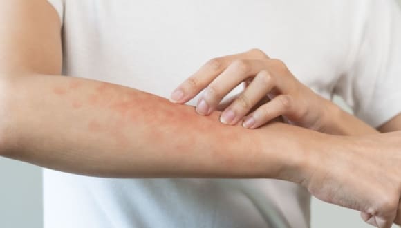 private allergy blood test