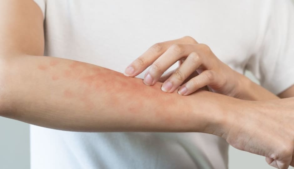 private allergy blood test