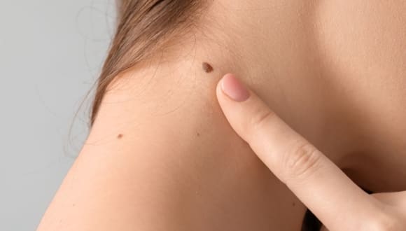 mole checks Portsmouth