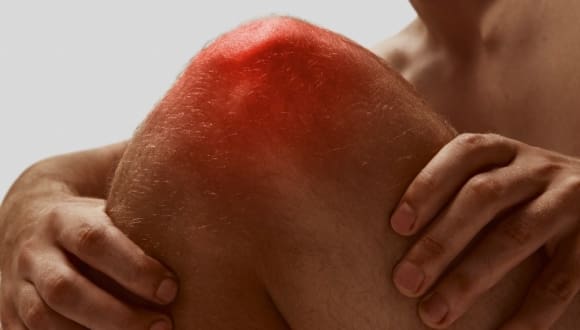 Arthrosamid Injection Portsmouth